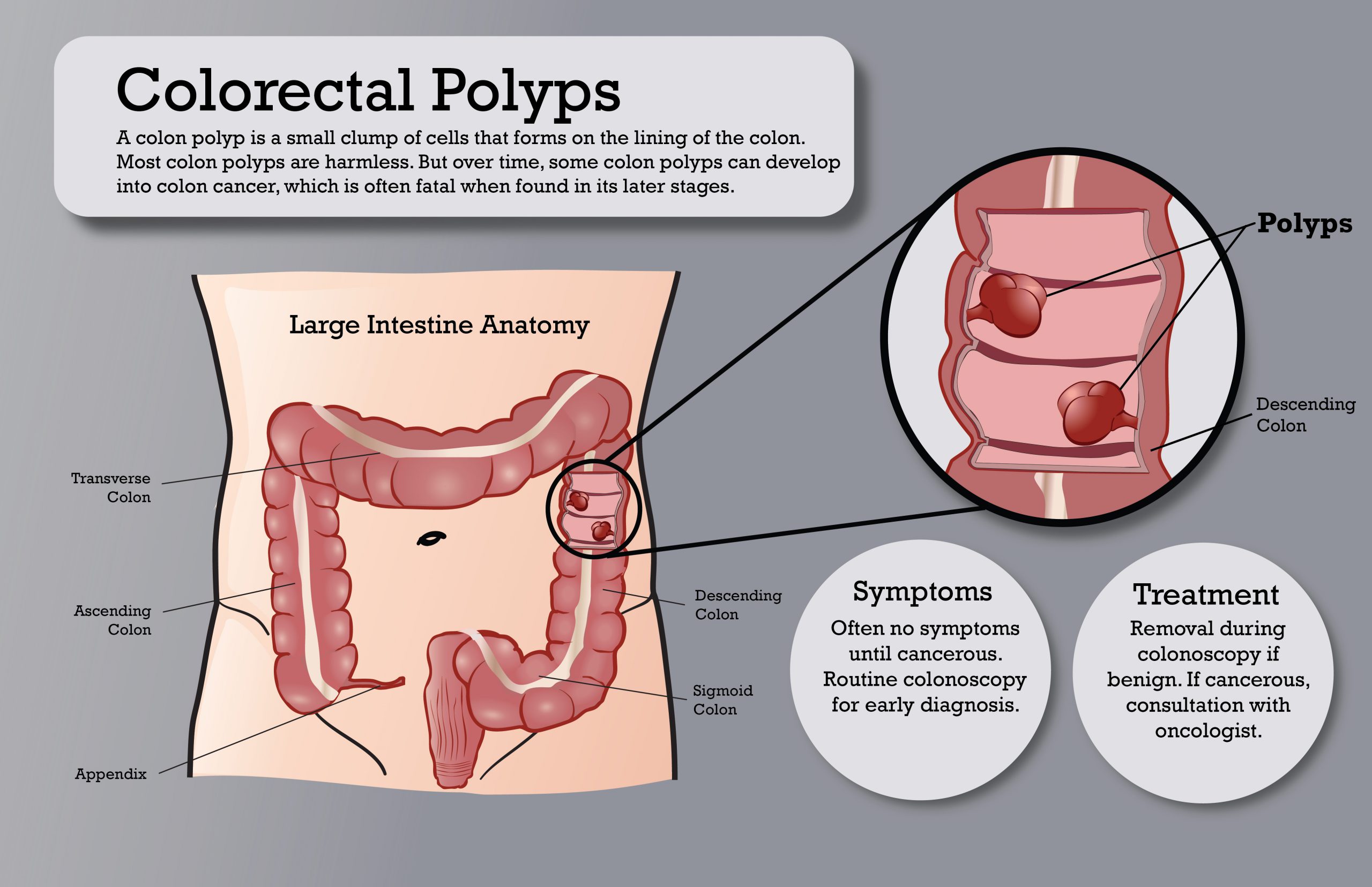 Colorectal-Polyps-poster-Recovered-01
